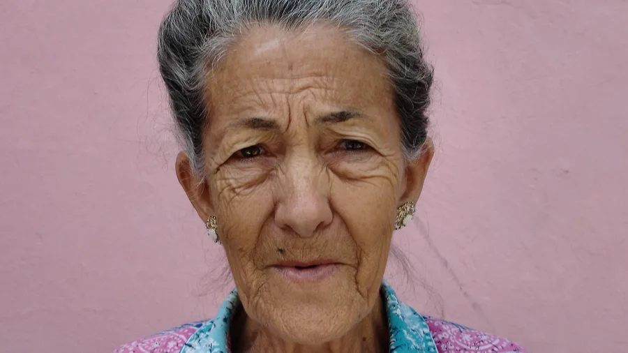Skin Thins and Becomes More Prone to Wrinkles